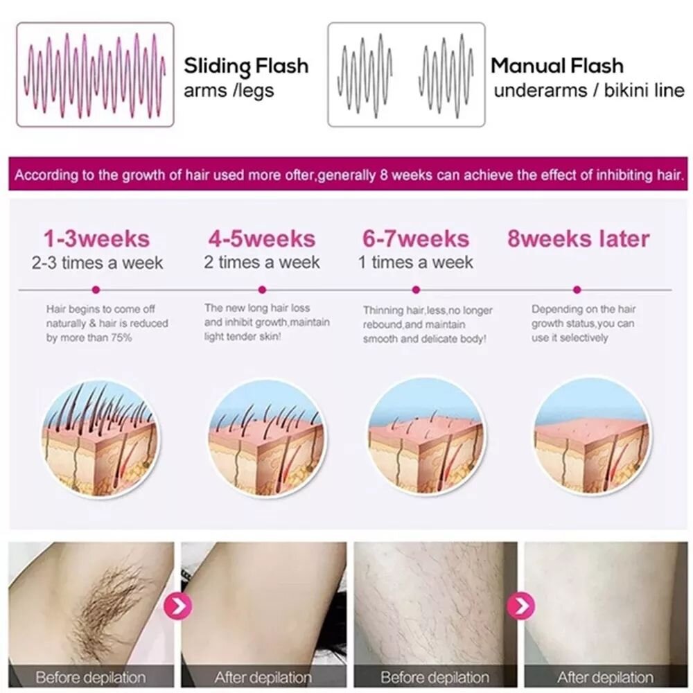 IPL Permanent Laser Hair Removal - 119.99 with free shipping on Gays+ Store 